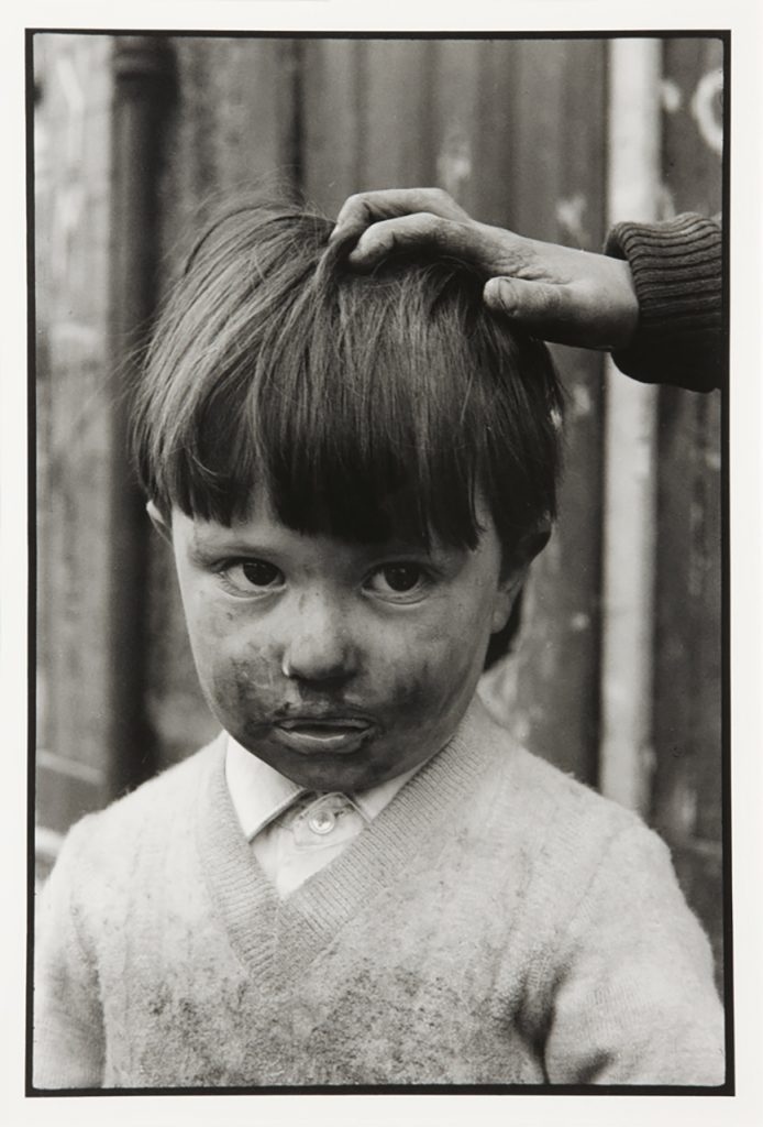 Black and white photograph of a young boy with a dirty face staring away from the camera.